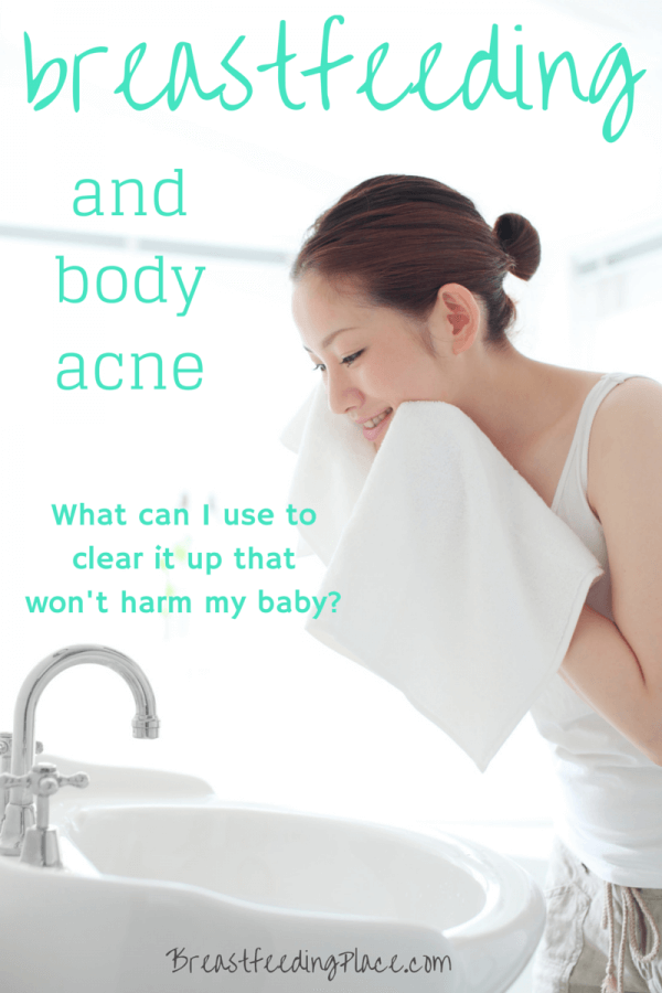 Breastfeeding and Body Acne: What Can I Use to Clear it Up That Won't Harm My Baby?    BreastfeedingPlace.com #nursing #homeremedy